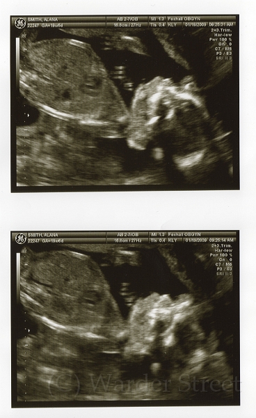 3rd Ultrasound 05.jpg